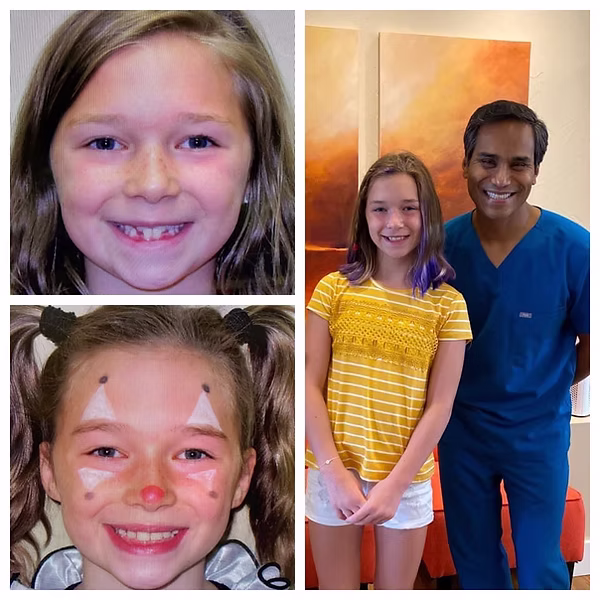 before and after photos